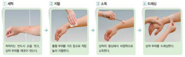 1. 세척 : 처치자는 반드시 손을 씻고, 상처 부위를 깨끗이 씻는다. 2. 지혈 : 출혈 부위를 거즈 등으로 직접 눌러 지혈한다. 3. 소독 : 상처의 중심에서 바깥쪽으로 소독한다. 4. 드레싱 : 상처 부위를 드레싱한다.