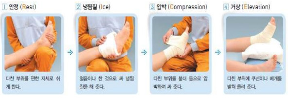 1. 안정 : 다친 부위를 편한 자세로 쉬게 한다. 2. 냉찜질 : 얼음이나 찬 것으로 싸 냉찜질을 해 준다. 3. 압박 : 다친 부위를 붕대 등으로 압박하여 싸 준다. 4. 거상 : 다친 부위에 쿠션이나 베개를 받쳐 올려 준다.